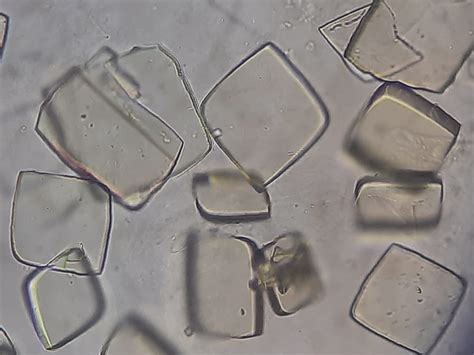 Amorphous urates present in urine means Archives - Medical Notes