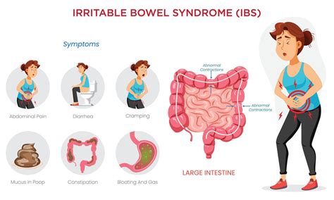 An IBS symptoms infographic highlights key signs like pain, bloating ...