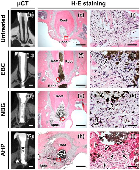 An Evaluation of the Biocompatibility and Chemical Properties of Two ...