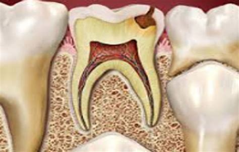 Aloe barbadensis gel, Allium sativum oil good option as pulpotomy ...