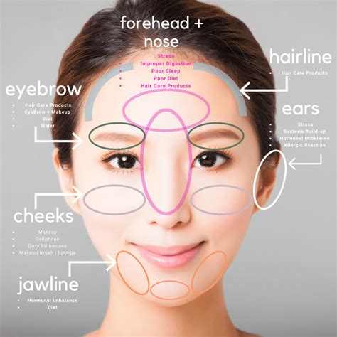 Face Mapping Acne Under Nose at Ruth Sapp blog