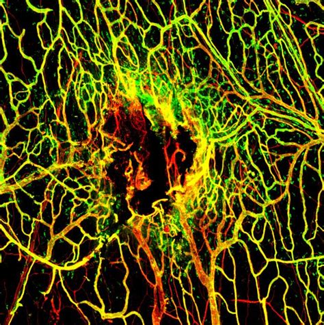Infection hinders blood vessel repair following traumatic brain or ...