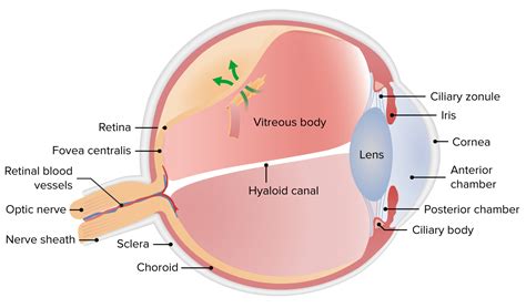 Desprendimiento de Retina | Concise Medical Knowledge