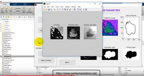 Image result for Skin Disease Detection Using MATLAB
