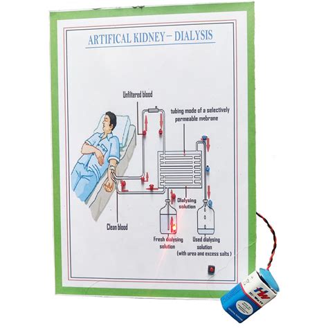 Buy Generic Artificial Kidney Dialysis Science Project Kit for High ...