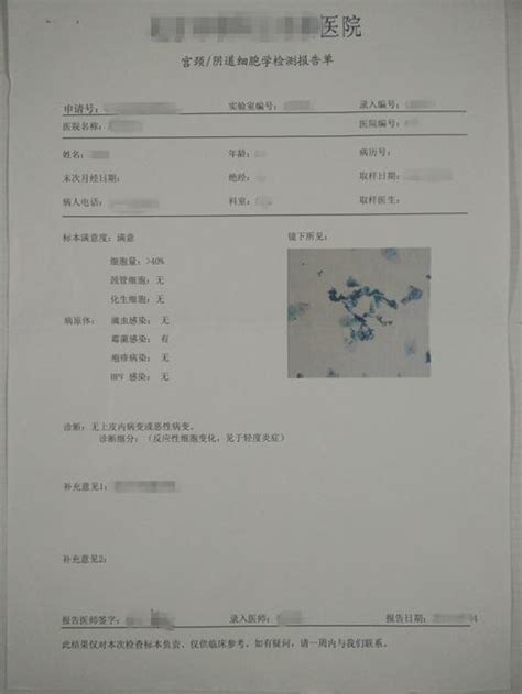 解读报告单之——TCT检测-刘彦春-春芽HPV讲堂