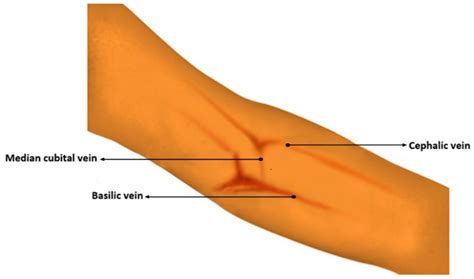 Median Cubital Vein