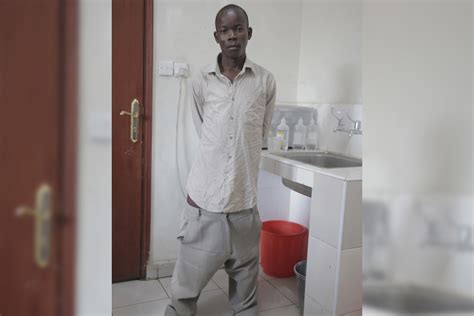 Man enjoys life after losing 3-foot-long penis