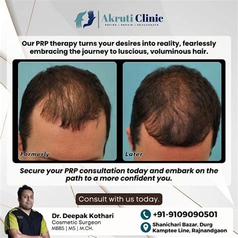 Hair Transplant in Kawardha