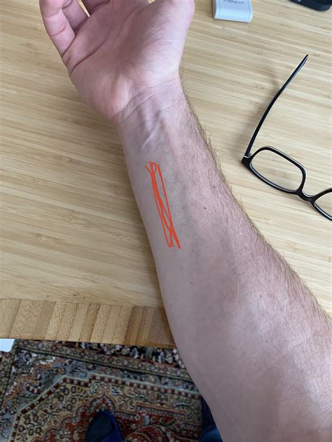 Pain Under Forearm at Tyson Walsh blog