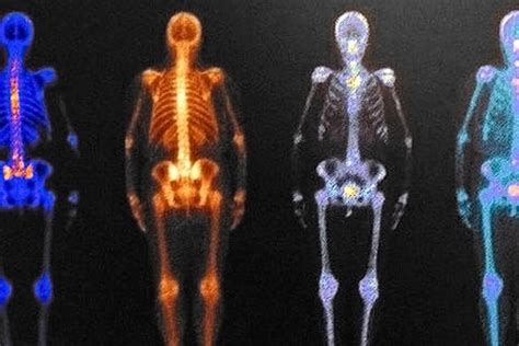 Image result for Radioactivite Corps Humain