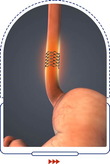 Gastroenterology Clinic in Vijayawada | Best Gastroenterologist in ...