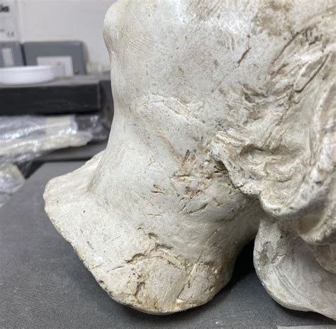 Curing Plaster Cast 的图像结果