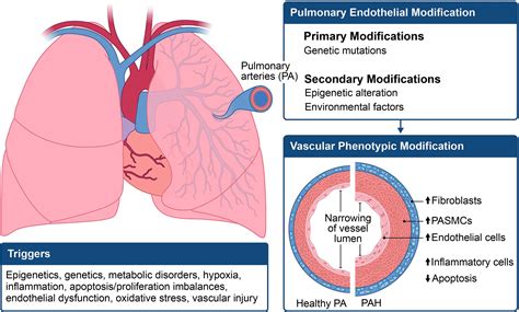 Frontiers | Exploring the pathogenesis of pulmonary vascular disease