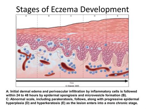 Dermatopathology2 | PPT