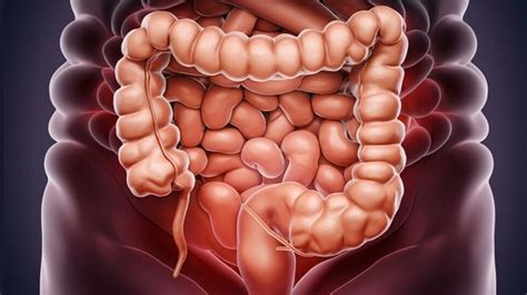 Top 5 warning signs of colon cancer that you need to recognise ...