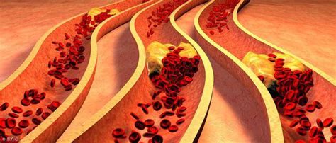 血液黏稠如何稀释-科康科技