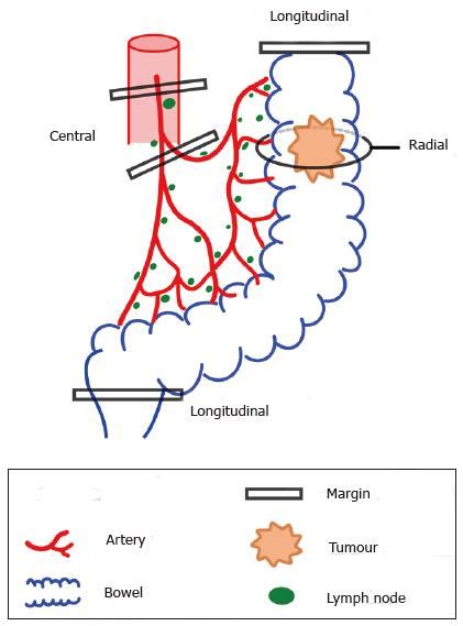 Kuvatulokset haulle pericolonic lymph nodes