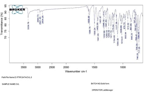Fig. 2: Carvedilol IR spectrum