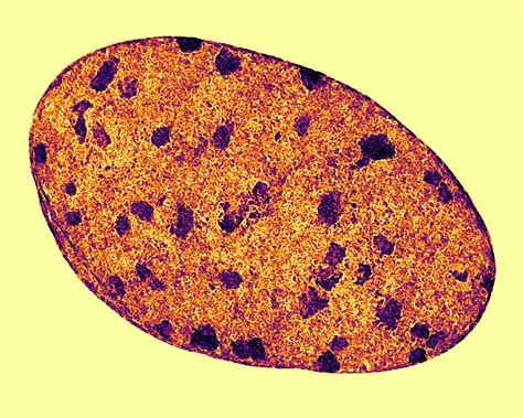 Image taken with a light microscope showing the organization of DNA in ...