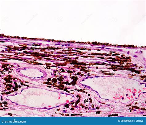 Eye. Choroid stock image. Image of eyeball, microscopy - 303600353