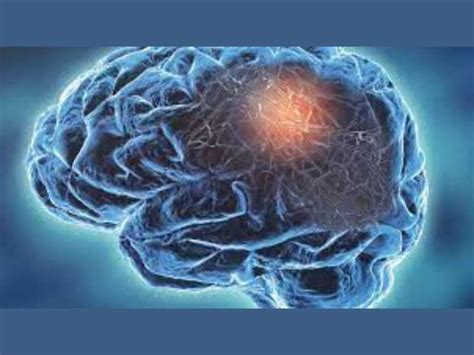 Lancet Study Warns About Neurological Disorders Increase And Indicates ...