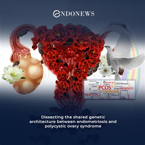 Endometriosis and PCOS Share Common Risk Genes | EndoNews