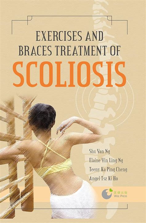 Exercises and Braces Treatment of Scoliosis eBook : Ng, Shu Yan , Ng ...