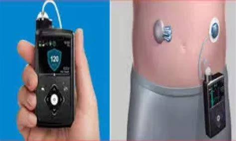 Use of open-source automated insulin delivery tied to better target ...