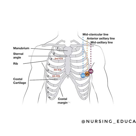 Midclavicular Line 5th Intercostal Space