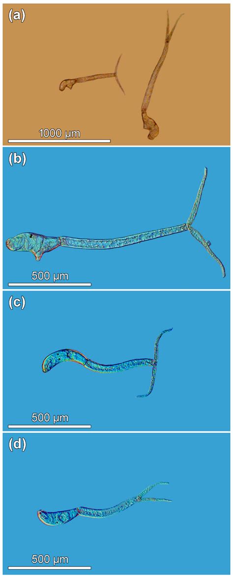 Somatic Dimorphism in Cercariae of a Bird Schistosome