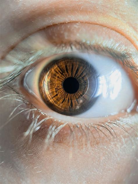 ¿Qué es el Glaucoma? - Horus Grupo Oftalmológico