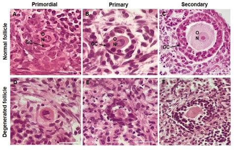 Protective Effect of Cimicifuga racemosa (L.) Nutt Extract on Oocyte ...