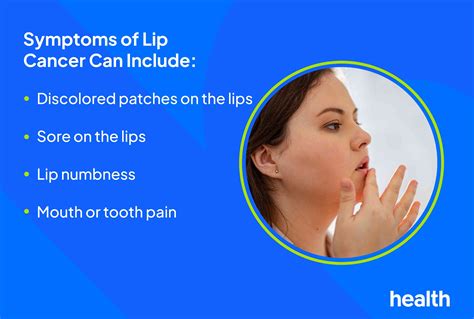 Cancer White Spots On Lips Pictures And Names Female - Infoupdate.org