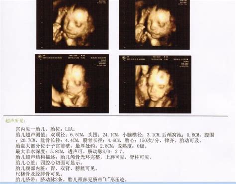 怀孕26周，四维确认男宝一枚，给大家分享症状吧！ - 知乎