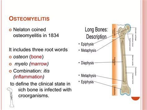 Osteomyelitis | PPTX