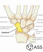 Image result for scaphoid