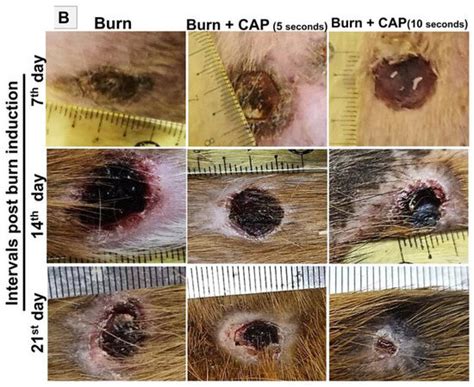 Cold Atmospheric Plasma Enhances TGF-β1, CTGF Protein Expression, and ...