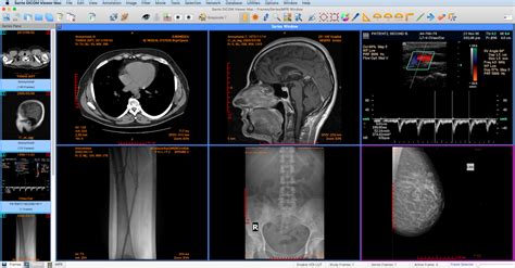 Les 5 Meilleurs Dicom Viewer En Ligne Pour Ouvrir Les Images Medicales ...