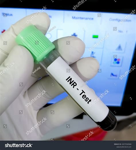 816 Blood Coagulation Patient Images, Stock Photos & Vectors | Shutterstock