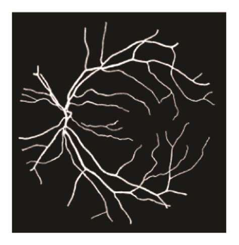 Image result for Channel AV Classification