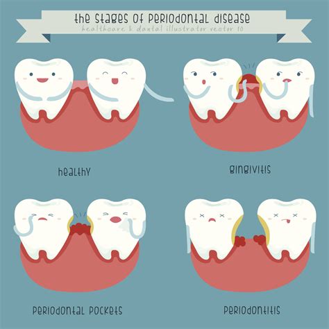 The Different Types of Gum Disease | smilesbygeorge