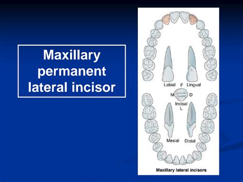 SOLUTION: Maxillary permanent lateral incisor dentistry - Studypool