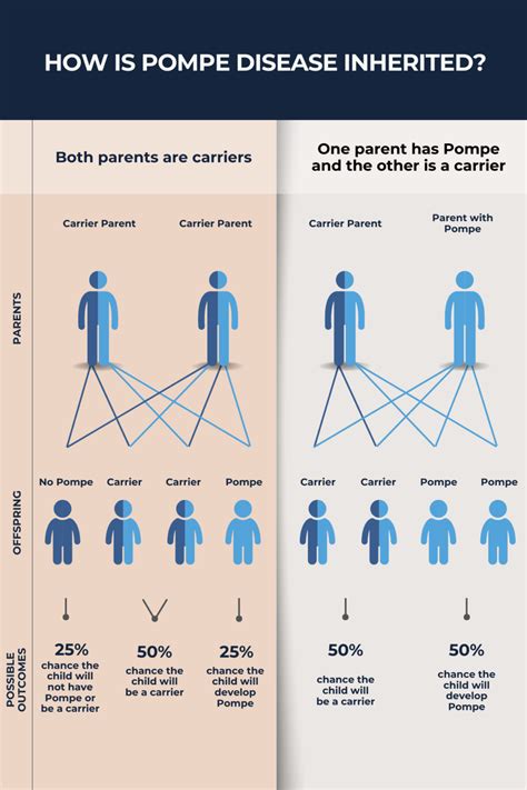 Pompe disease inheritance | Pompe Disease News