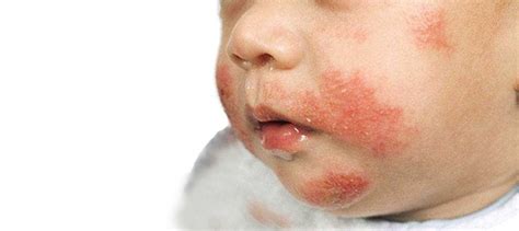 Medsim for Health Workers