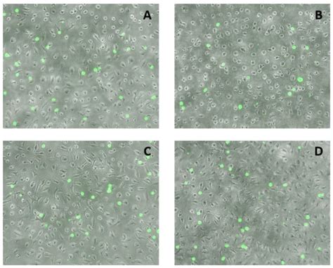 Conjugated Linoleic Acids Have Anti-Inflammatory Effects in Cultured ...