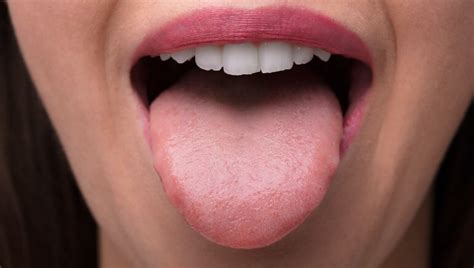 What you need to know about covid tongue, and how coronavirus affects ...