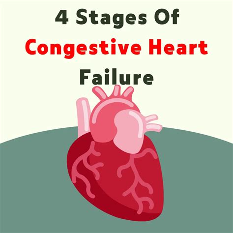 What Are The 4 Stages Of Congestive Heart Failure: From Stage 1 to Stage 4 | HealthFness