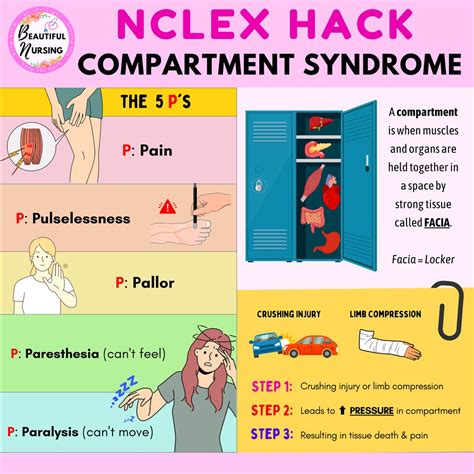 Compartment syndrome – Artofit