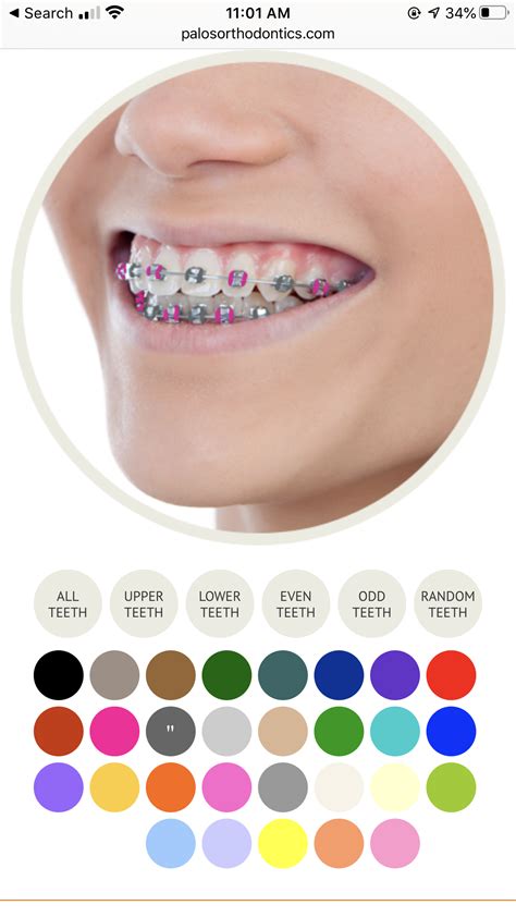 Hot pink and gray brace rubber bands | Braces colors, Braces rubber ...